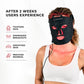 VISO FDA-Certified Red Light Therapy Mask