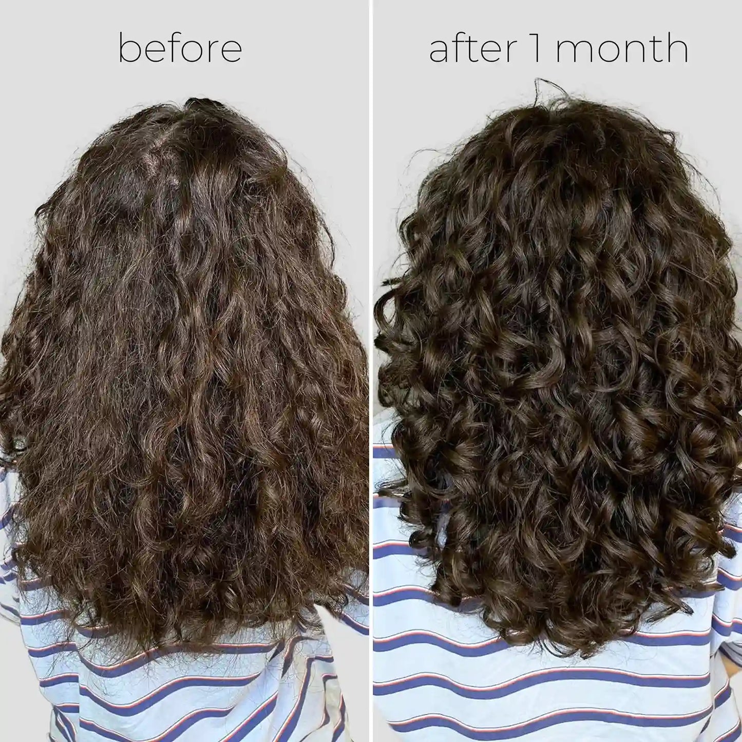 Hair Oil Capsules for Frizzy Hair