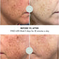 VISO FDA-Certified Red Light Therapy Mask